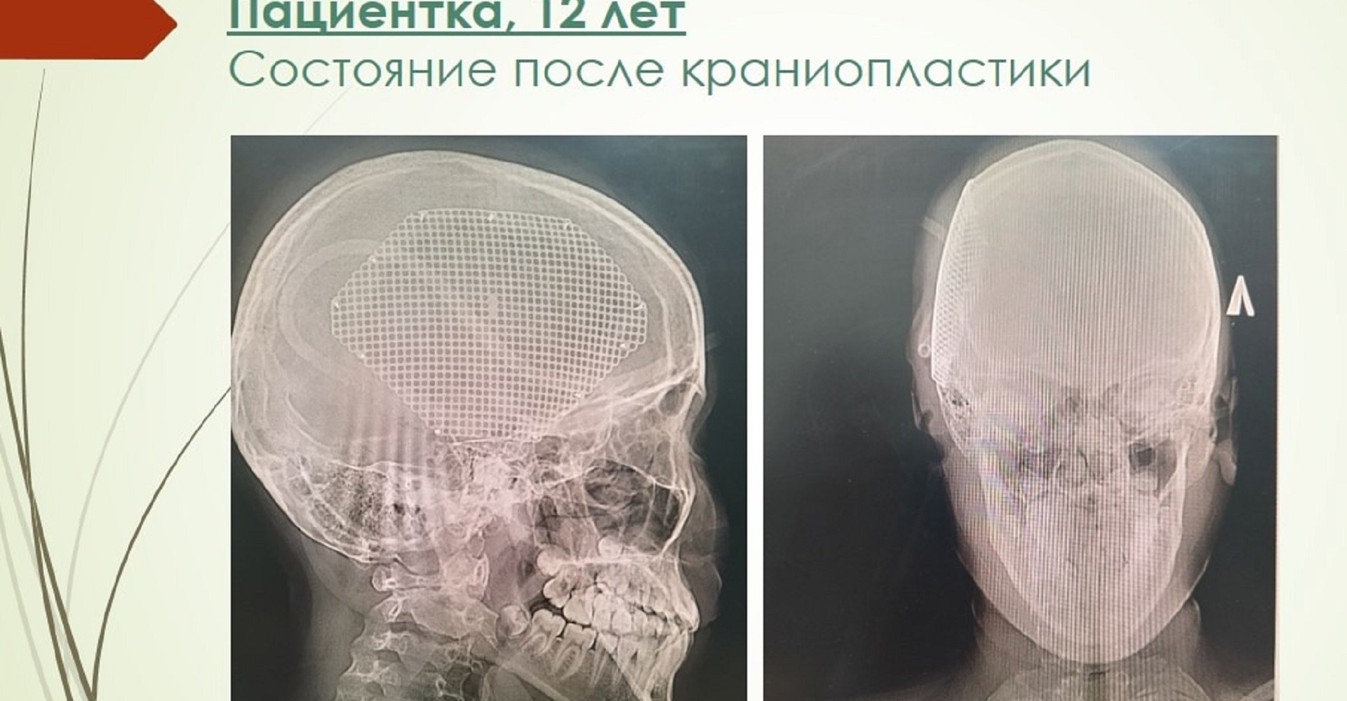 Новость