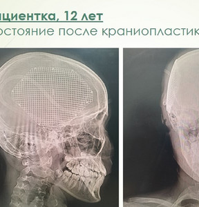 Новость